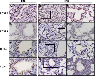 Identification of SOX2 Interacting Proteins in the Developing Mouse Lung With Potential Implications for Congenital Diaphragmatic Hernia